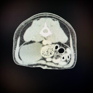 CT image 1