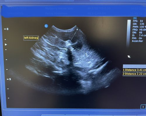 Image 4 Kidney stone cat ultrasound