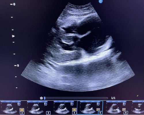 Image 5 Heart ultrasound